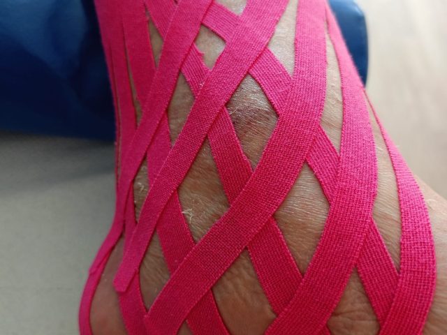 Kinesiotaping